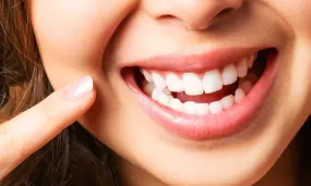 Zoom Laser Teeth Whitening Session at La Glace Aesthetics, Milnerton